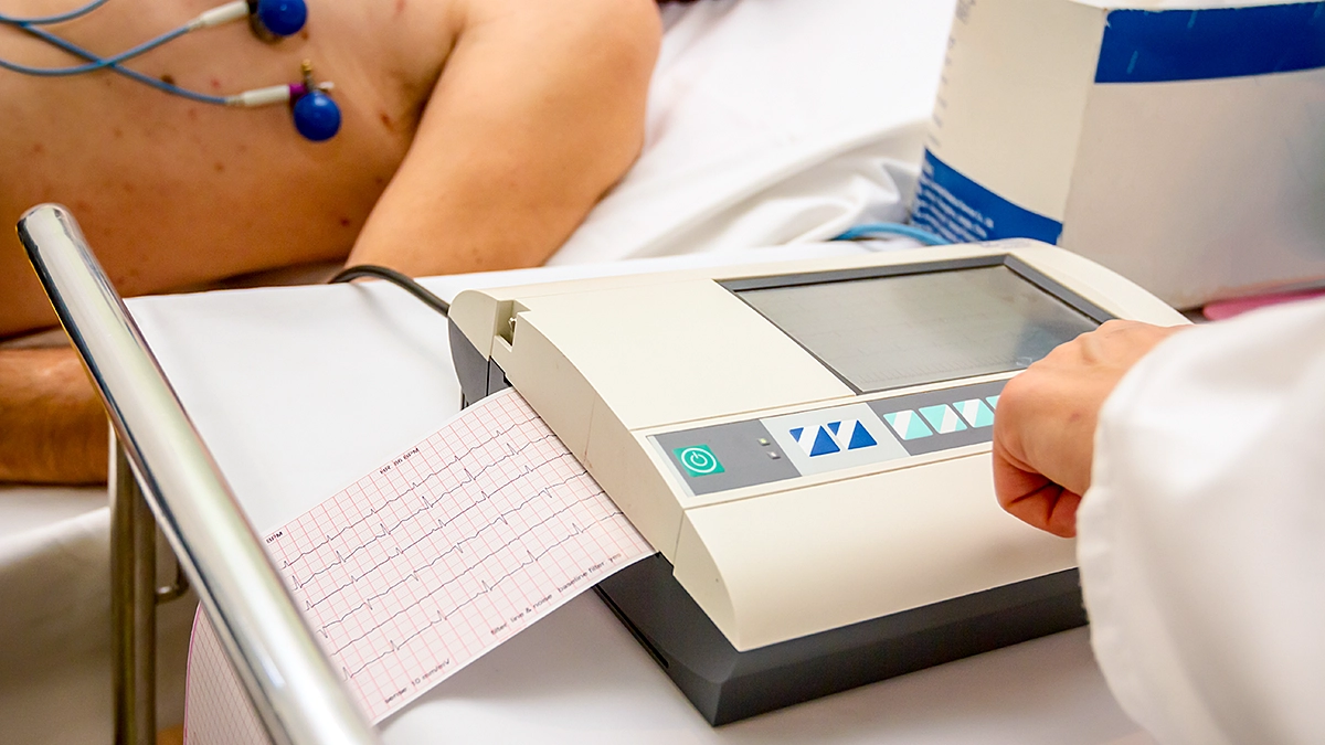 Decoding Loop Recorders and ICM Implants How Continuous Monitoring